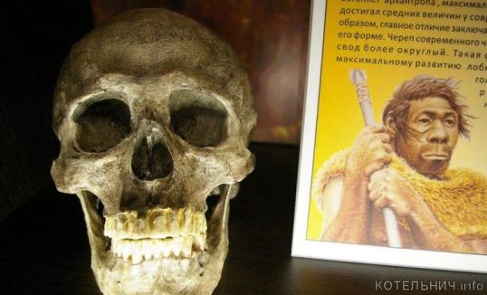 Улыбка &laquo;Люси&raquo;