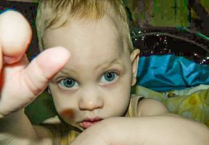 Помогите спасти малышу зрение