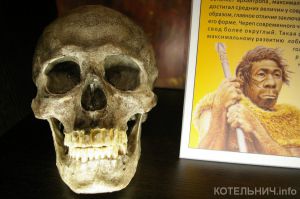 Улыбка &laquo;Люси&raquo;